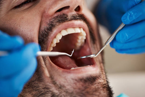 Best Urgent Care for Lost Fillings or Crowns in Terre Du Lac, MO